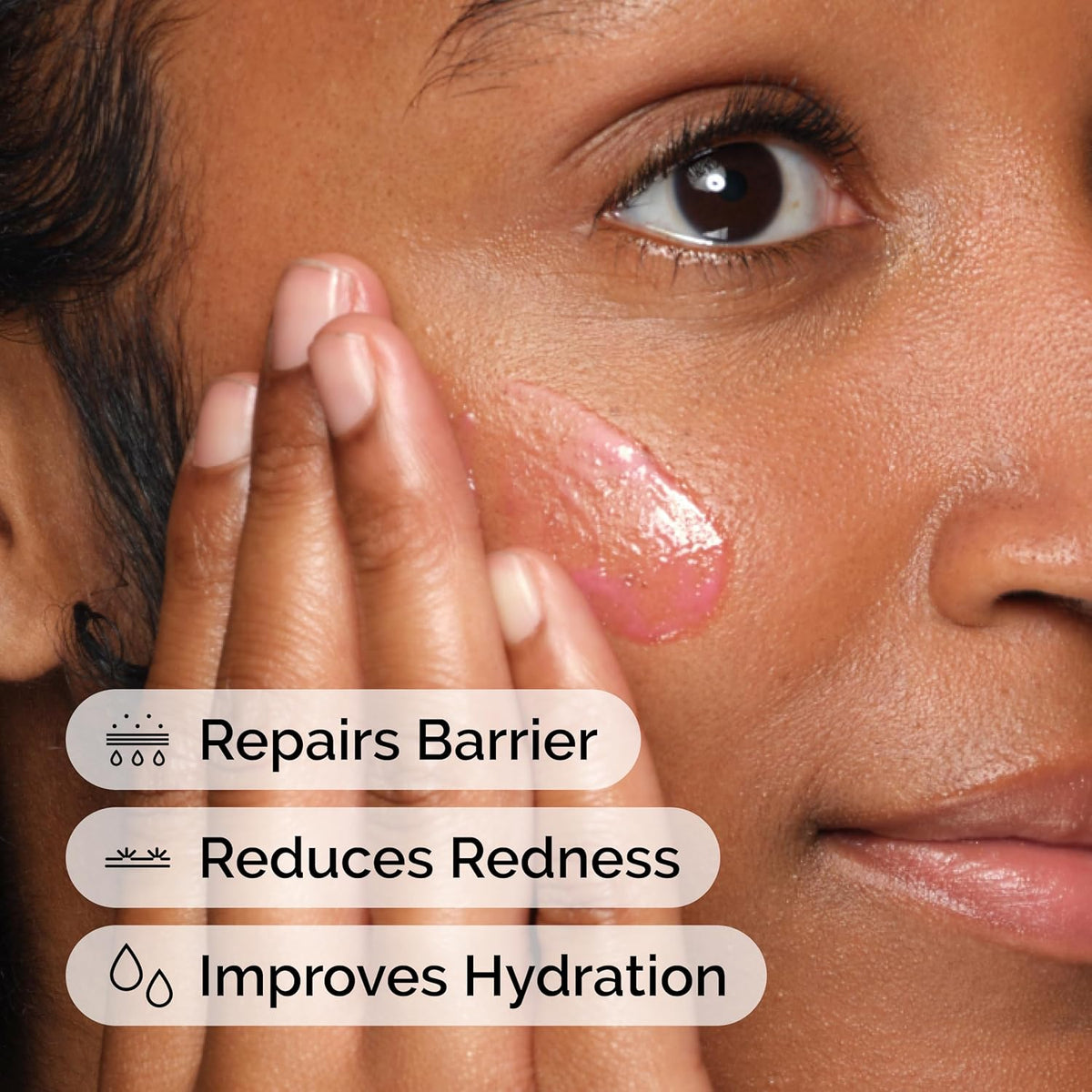 The Ordinary Soothing Barrier Support Serum